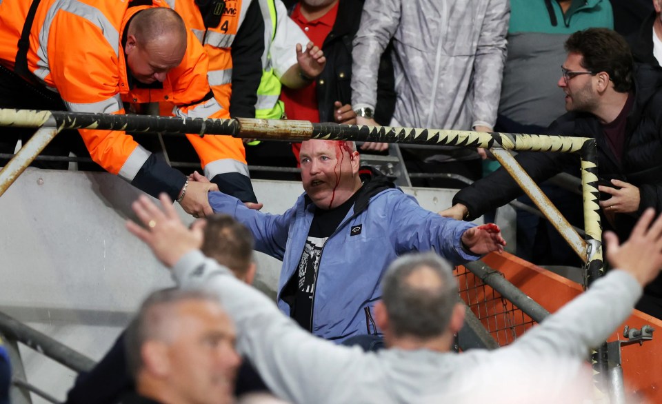 Leeds fan left covered in blood after ‘falling on to TV gantry’ during Championship clash vs Hull