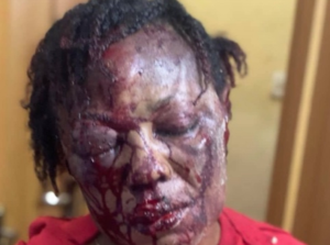 Man Disfigures Wife’s Face In Delta