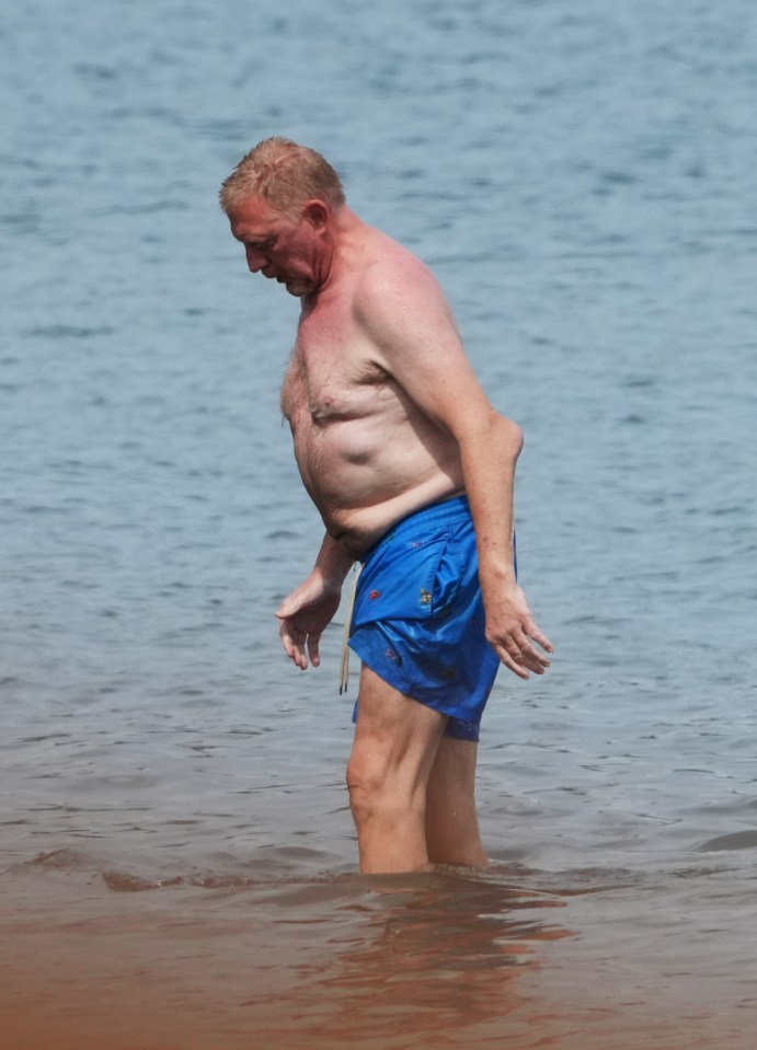 Shamed Wimbledon champ Boris Becker shows off gruesome elbow injury as he hits beach with fiancee 23 years his junior