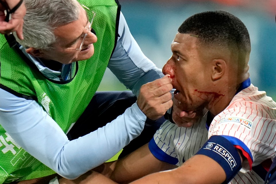 Former boxer who broke nose 15 TIMES fires warning to Kylian Mbappe after horror injury in France’s Euro 2024 opener