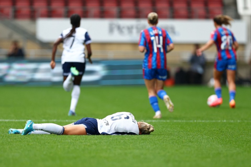 Tottenham star shows off gruesome black eye after injury following incident that went unpunished by referee